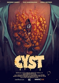 Cyst